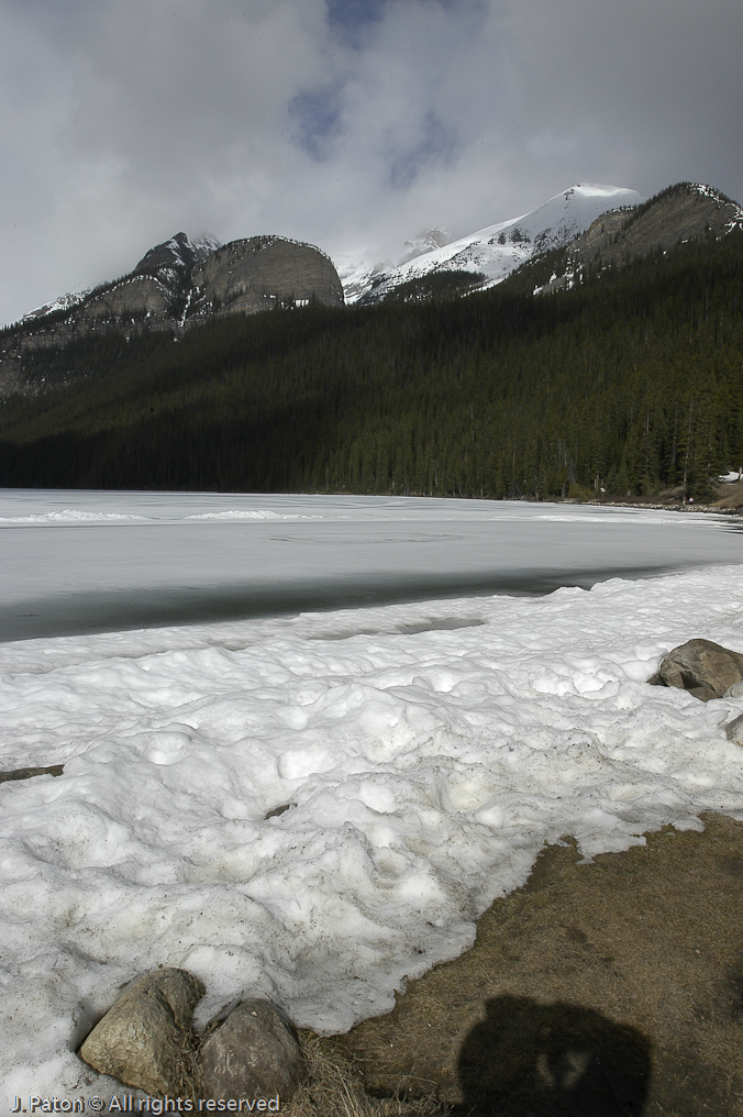   Lake Louise, Banff National Park, Albert, Canada